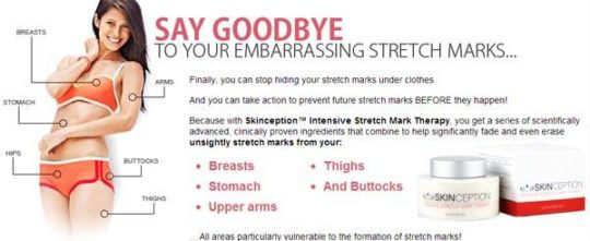 Skinception Stretch Mark Therapy