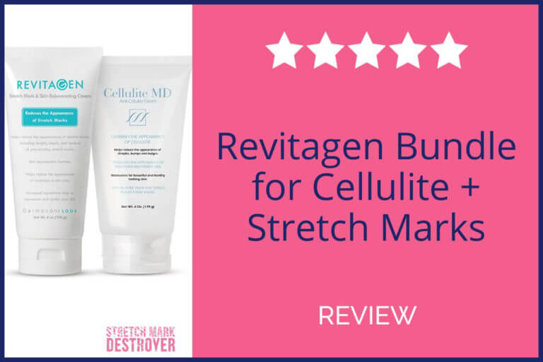 RevitaGen Stretch Mark Cream Review